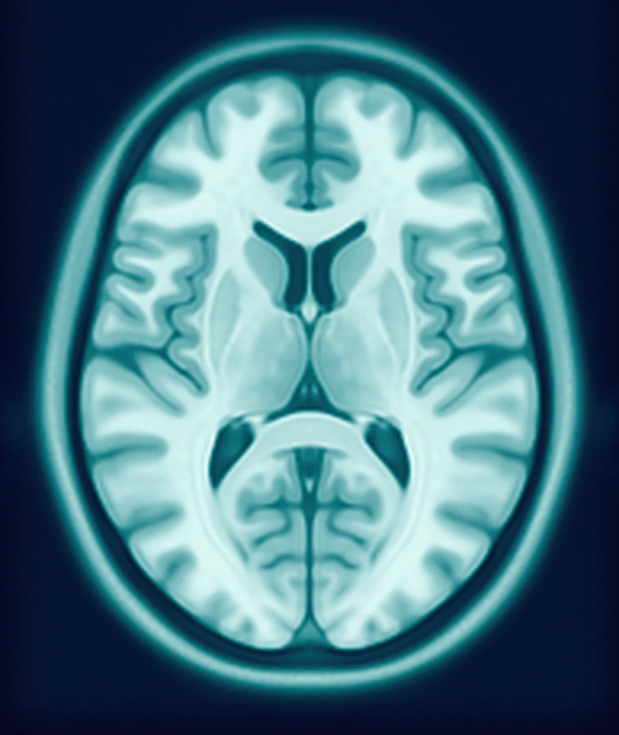 Axial T1 MRI slice through the thalamus and basal ganglia, ICBM152 reference volume